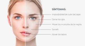 ¿Sabes usted que es una parálisis facial?